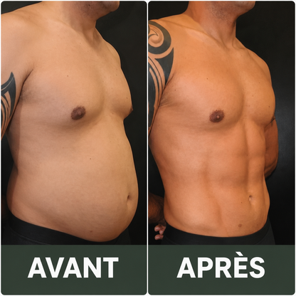 Fodiri™ | Ensemble de Bandage Intestinal à l’Huile de Ricin Réutilisable pour le Bien-être Intestinal