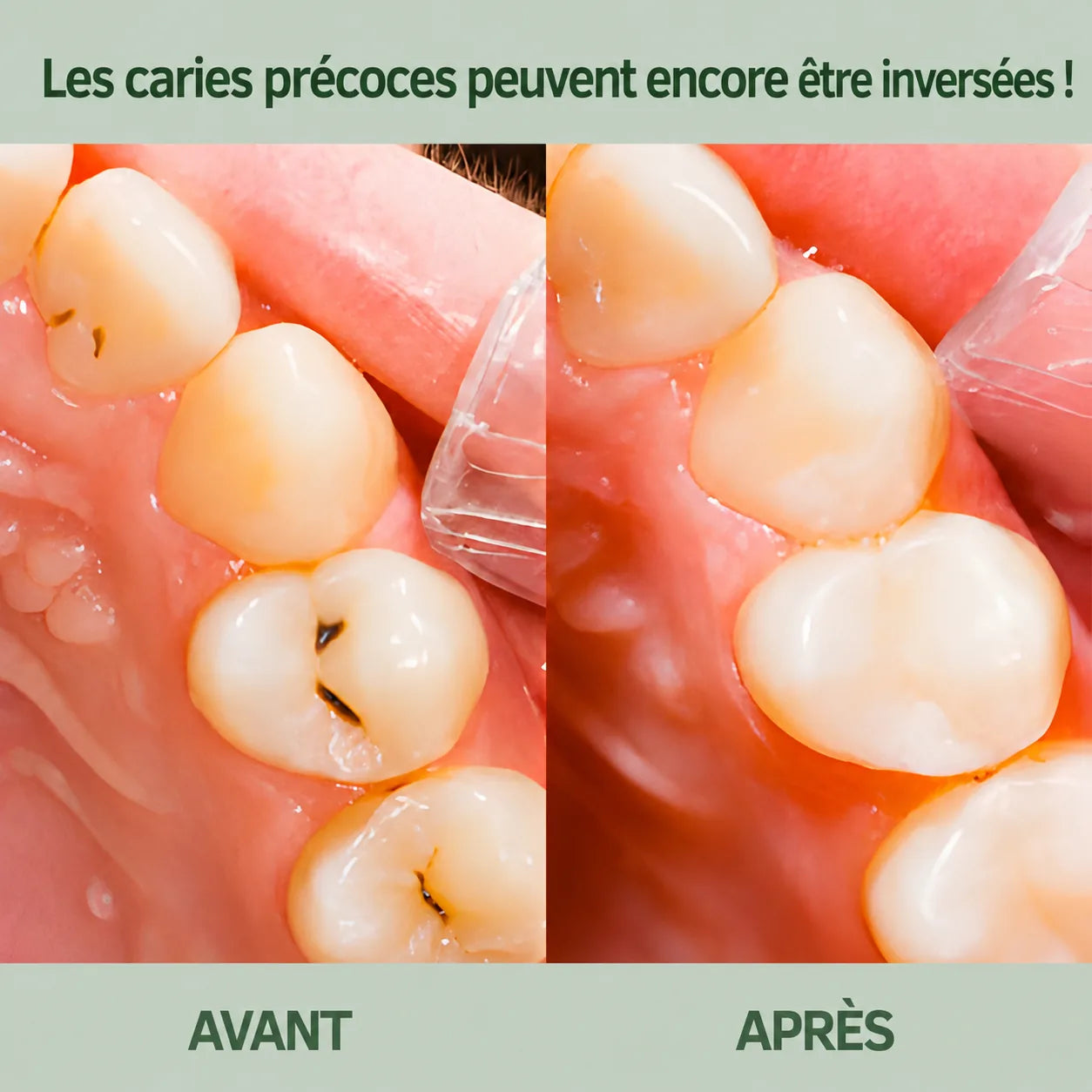 Chewing-gum reminéralisant à base de résine naturelle
